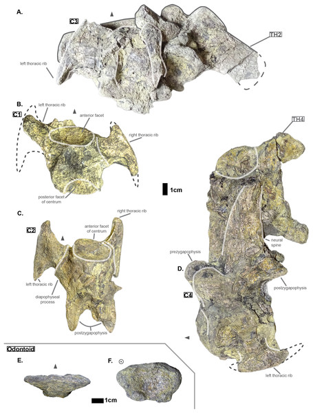 Cervicals of Cerrejonisuchus improcerus UF/IGM 31: (A) Cervical C‘3’ in dorsal view; (B) Cervical C‘1’ in dorsal view; (C) Cervical C‘2’ in dorsal view; (D) Cervical C‘4’ in lateral view (left); (E) Odontoid in dorsal view; (F) Odontoid in anterior view. Cervical C‘3’ and C‘4’ are respectively fused to Th‘2’ and Th‘4’. Scale bar represents 1 cm. Grey arrow points towards anterior.