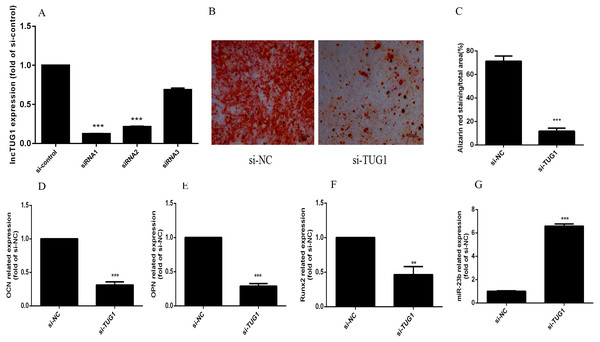 (A–G) Knockdown of TUG1 suppressed osteoblastic differentiation of hBMMSCs in vitro.
