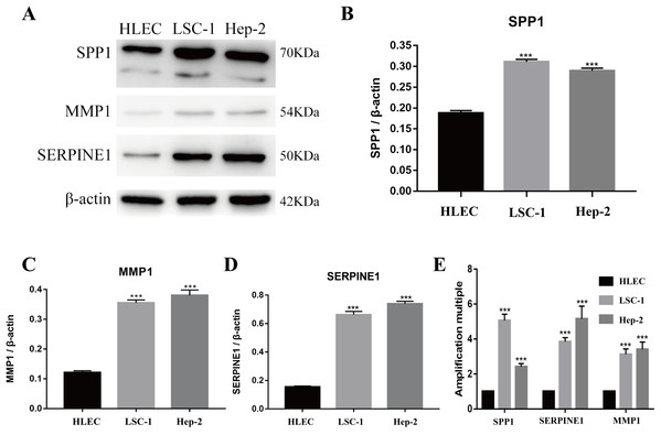 Expressions of SPP1, SERPINE1 and MMP1 in LSCC cells and HLEC.