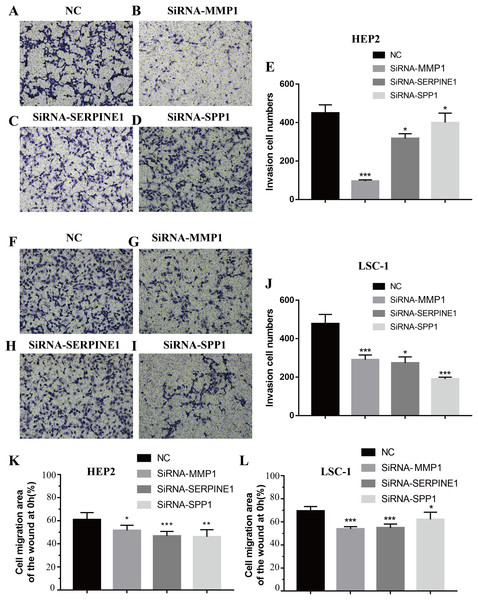 Effects of MMP1, SERPINE1 and SPP1 on LSCC cells migration and invasion in vitro.