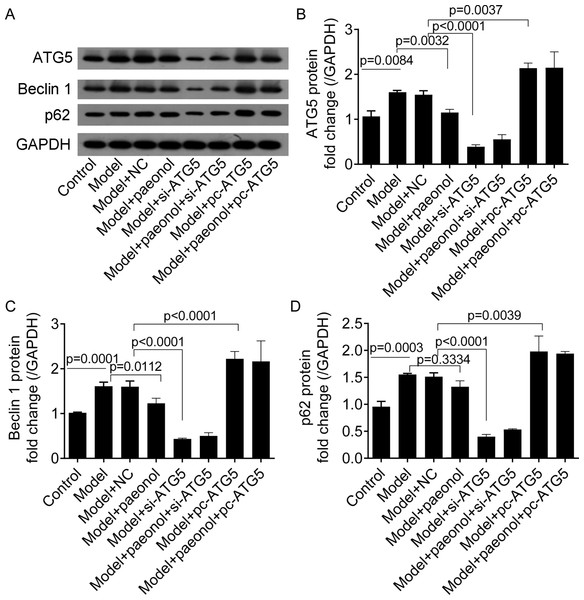 The expression of ATG5, Beclin 1, p62, and GAPDH proteins in HaCaT cells.