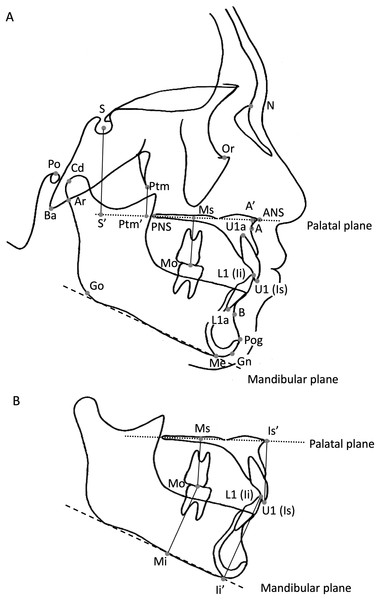 Characteristics of craniofacial morphology and factors affecting them ...