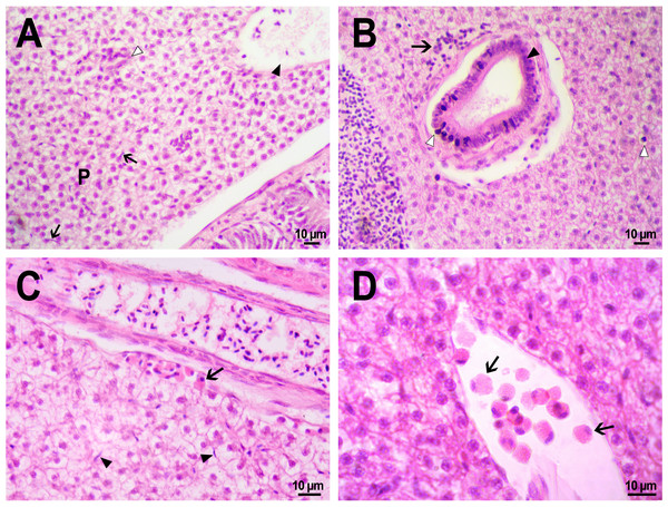 Morphological structure of zebrafish liver after PMs-PEG injection into fish kidney.
