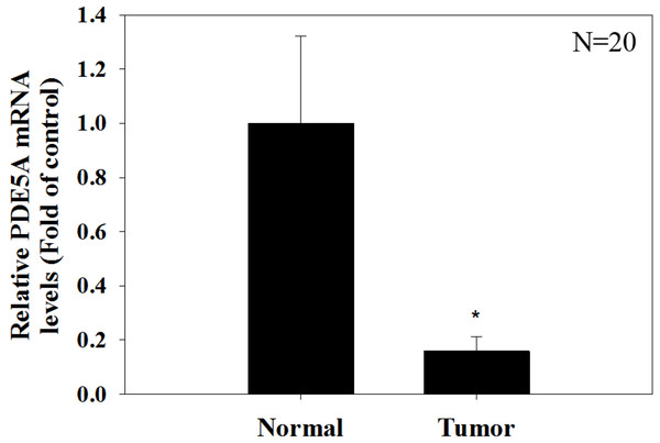 Paired UTUC tissues (normal and tumor) from 20 patients were evaluated for PDE 5A expression through real-time PCR.