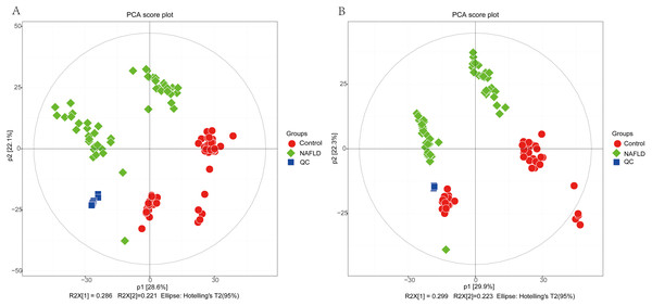 The PCA score plot of 50 healthy controls (red spots) and 50 NAFLD patients (green squares).