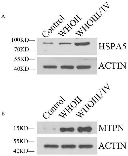 The expression of HSPA5 and MTPN by Western blot.