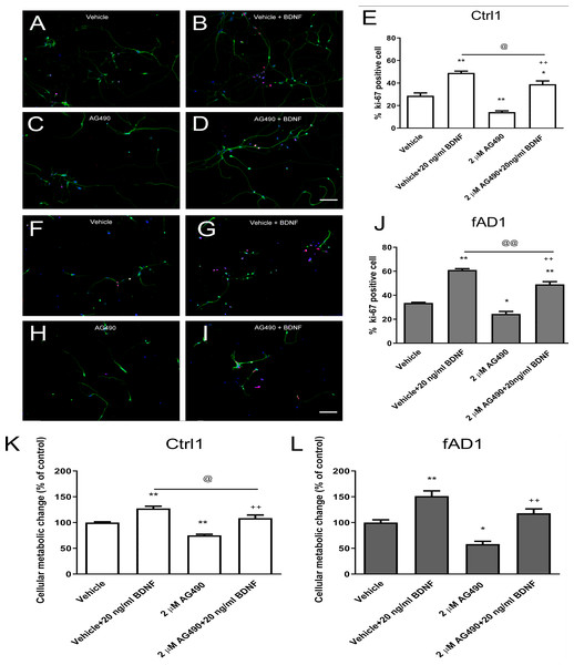 JAK2 inhibitor partially inhibits cell proliferation in the presence of BDNF.