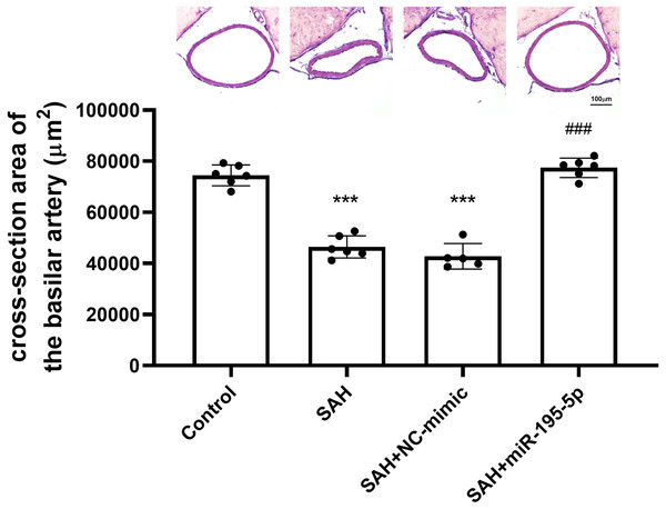 Bar graphs showing the effects of miR-195-5p on cerebral vasospasm in cross-sectional areas.