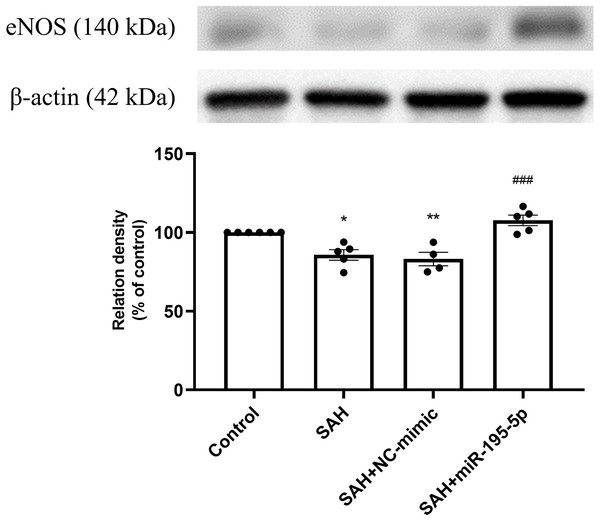 Western blotting for basilar artery eNOS and β-Actin.