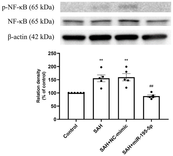 Western blotting for basilar artery p-NF-κB/NF-κB and β-Actin.