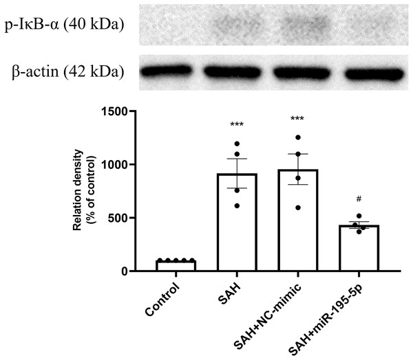 Western blotting for basilar artery p-IκBα and β-Actin.