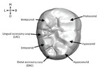 Accessory cusp expression at the enamel-dentine junction of hominin ...