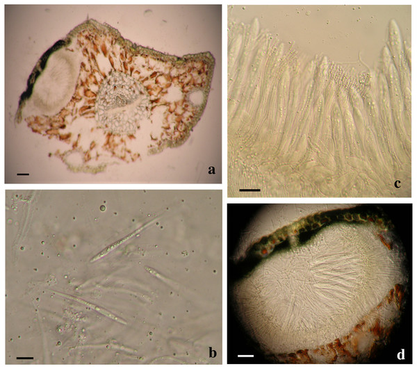 Morphological characters of Lophodermella. sp. on Pinus flexilis collected from Rocky Mountain National Park, Colorado, USA.