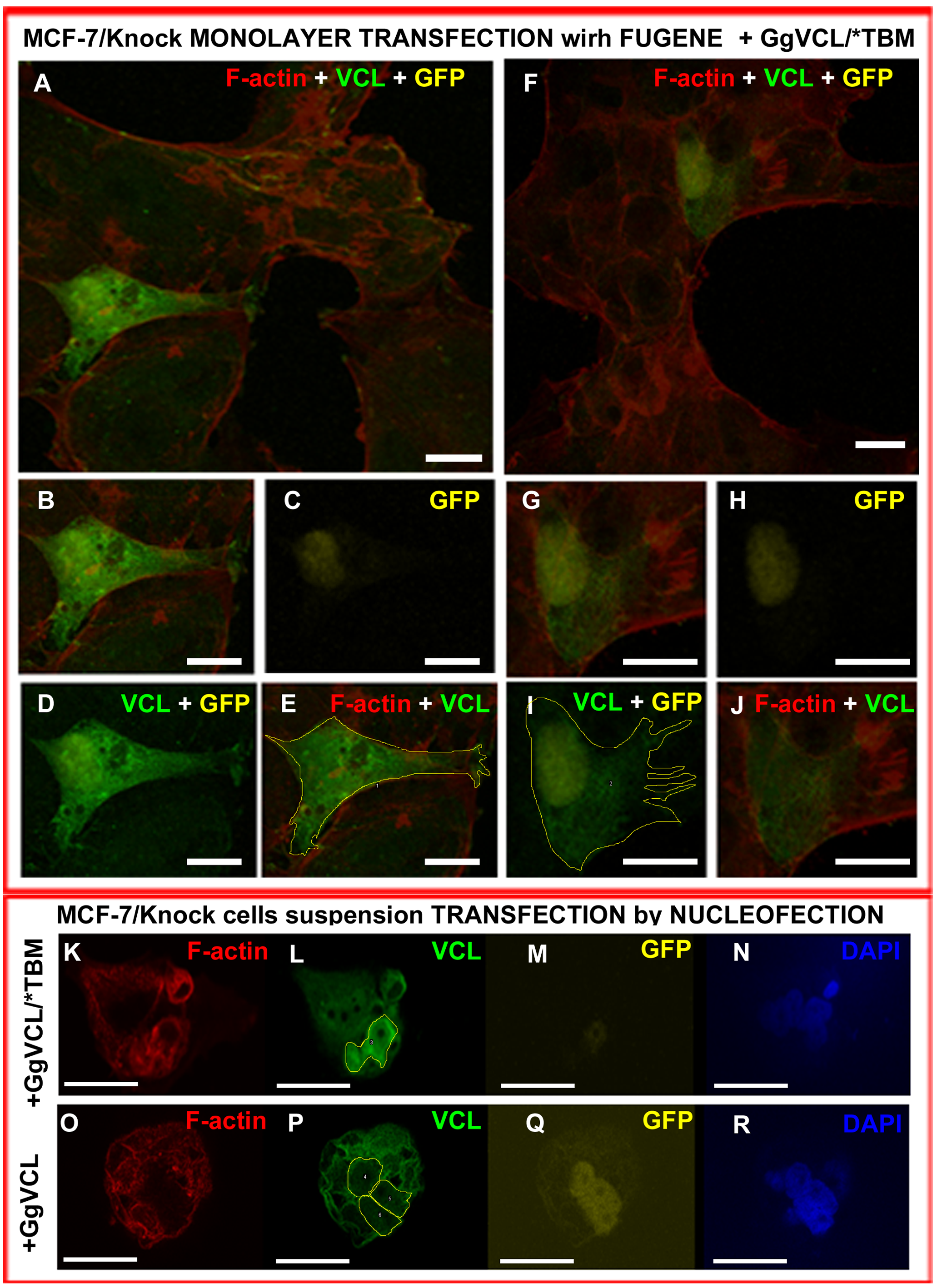 First Body Of Evidence Suggesting A Role Of A Tankyrase Binding Motif Tbm Of Vinculin Vcl In Epithelial Cells Peerj