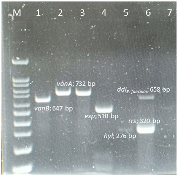 Multiplex PCR positive isolates.