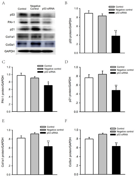 Effects of p53 knockdown on protein expression levels of PAI-1 and Col 1A1/3A1 in human atrial fibroblasts.