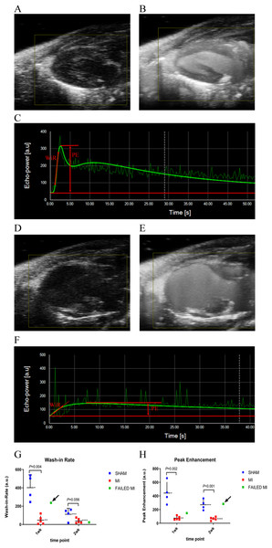 Example ultrasound images of the 2D PLAX view of the left ventricle at multiple stages during the process of microbubble injection.