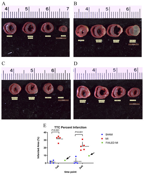 TTC stained hearts collected at endpoint.