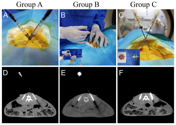 Different methods of tumor implantation.