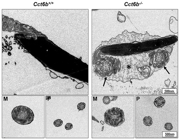 Electron microscopy images of Cct6+/+ and Cct6b−/− spermatozoa.