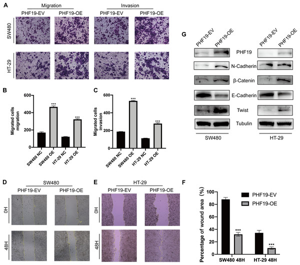 Overexpression of PHF19 promoted CRC cell migration and invasion by inducing EMT in vitro.