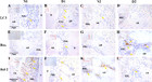 Expression of autophagy and apoptosis-related factors in the ...