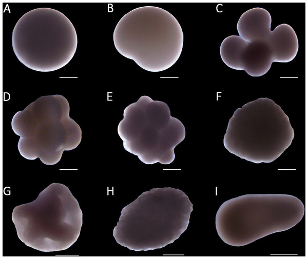 Stages of embryo development of the octocoral species Dentomuricea aff. meteor.