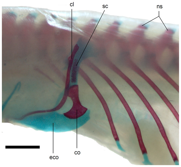 Pectoral girdle of perinatal Anguis fragilis (MNHW-Reptilia-0312) in lateral view.