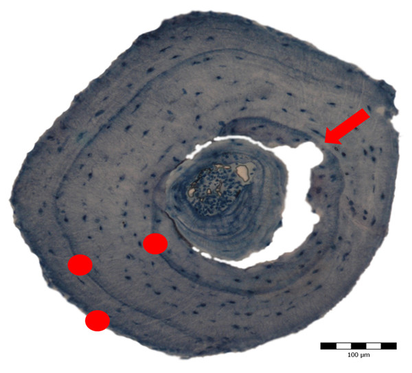 Cross section obtained through skeletochronology from the mid-diaphysis of a phalanx from a 3-year old adult Pelobates fuscus sampled in 2004.