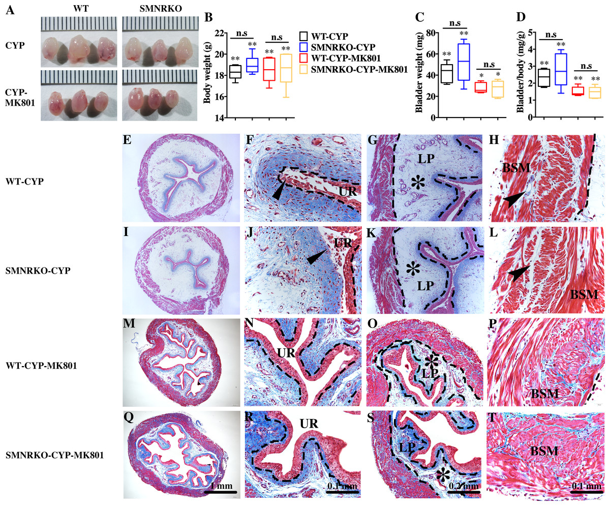 NMDAR in bladder smooth muscle is not a pharmacotherapy target for  overactive bladder in mice [PeerJ]