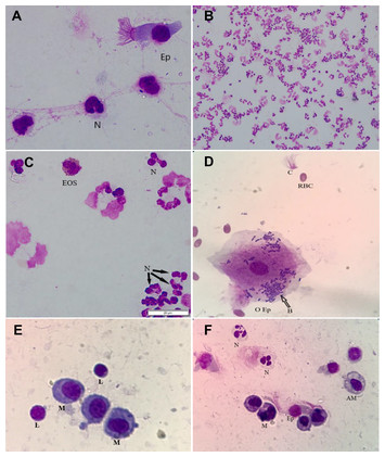 Cytological analysis of tracheal wash and bronchoalveolar lavage fluid ...