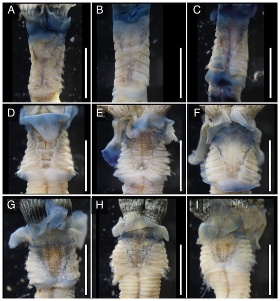 Variations in the thorax of ethanol fixed specimens of Japanese Spirobranchus cf. kraussii.