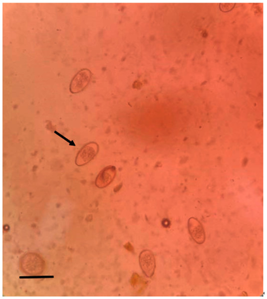 Microscopic examination of Eimeria sp. (400×) (scale bar = 10µm).