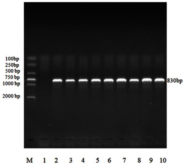 Electrophoresis map of nested PCR of 18S rRNA gene of Eimeria sp. in forest musk deer.