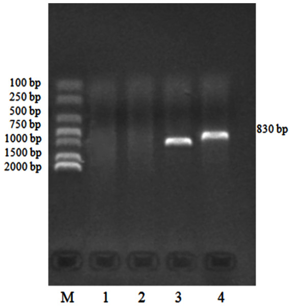 PCR identification of pMD19-T/18S rRNA recombinant cloning vector.