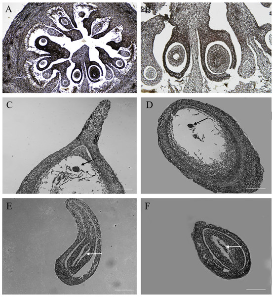 The microstructure observation of fertile and abortive ovules at 20 days after anthesis.