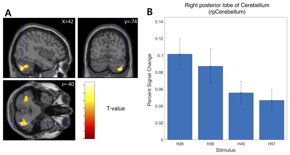 Neural correlates of tactile hardness intensity perception during ...