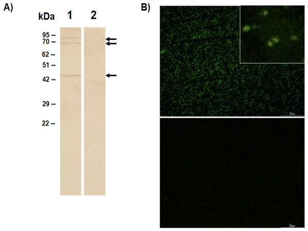 Recognition of native BbAMA-1 protein by rabbit polyclonal anti-sBbAMA-1 antibody.