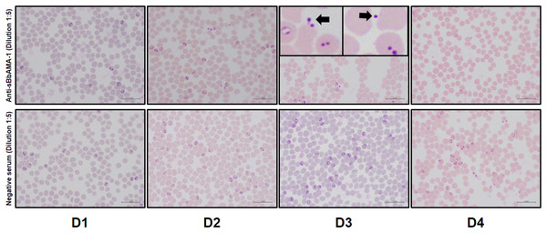 Light microscopic examination of blood smears from in vitro cultures treated with rabbit polyclonal anti-sBbAMA-1 antibody.