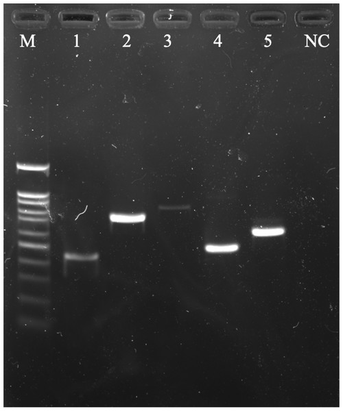 A 1.5% (w/v) agarose gel image showing the ESBL-encoding genes amplified from E. coli isolates isolated from vegetables using PCR method.