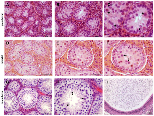 Histology of wild boar testes and epididymides after haematoxylin-eosin staining.