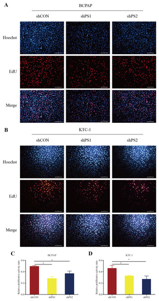 EdU assay of PROS1 knockdown groups and control groups of the two cell lines.