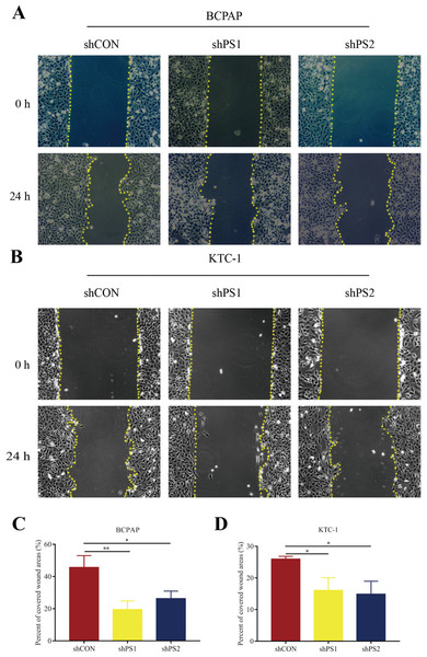 Wound-healing assay of PROS1 knockdown groups and control groups of the two cell lines.