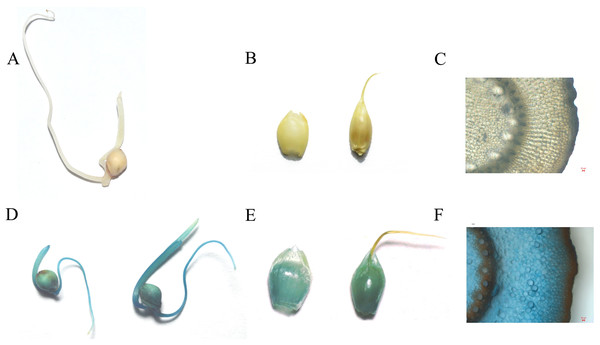 The GUS staining on control and transgenic T1 generation (A, B, C is control and C, D, E is T1 transgenic plant; A and C is seedlings; B and D is panicles; C and E is Stem, scale bar = 20 µm).
