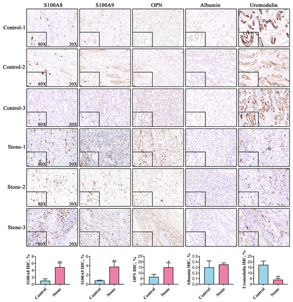 Representative images for detection of the top five stone matrix proteins in renal tissue.