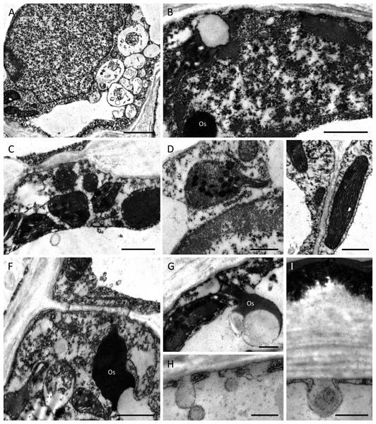Ultrastructure of nectary cells of B. scandens (A, B, D, E, G, H, I) and B. whartoniana (C, F), TEM.