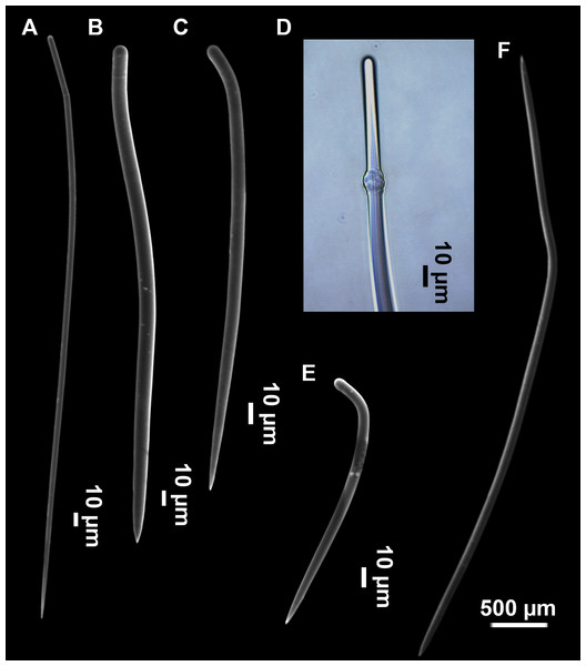 SEM images of the spicules from Foraminospongia balearica sp. nov. CFM-IEOMA-7358/i293_1 (paratype).