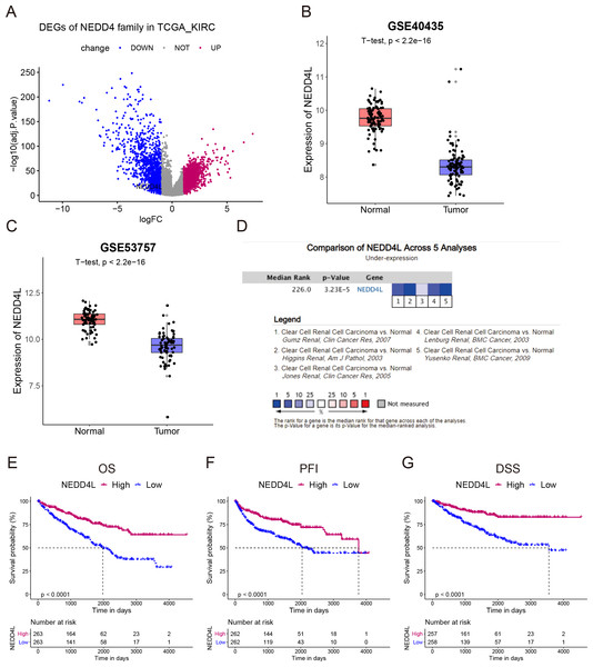 Expression and prognostic analysis of NEDD4L in ccRCC.