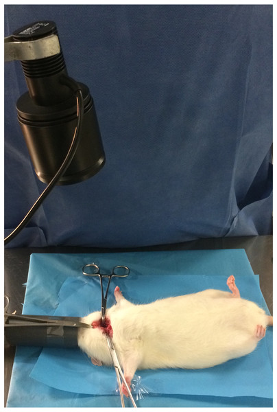 Intraoperative image showing the LED source.