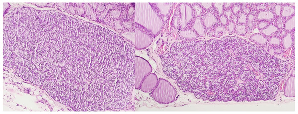 Optical microscopy of parathyroid samples of groups 1 (left) and 2 (right) HE X100.